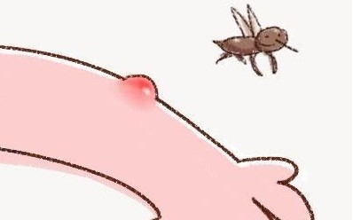 被蚊子咬了，用指甲在蚊子包上“画”十字止痒，是好方法吗
