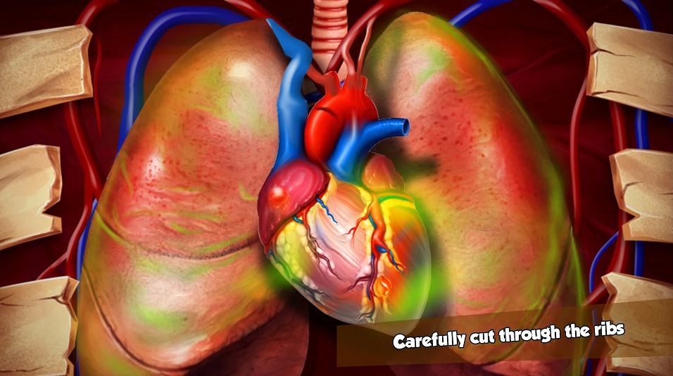 heart surgeryapp下载