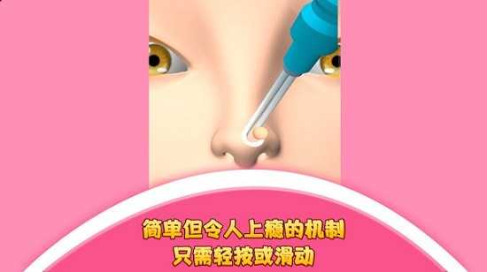 我爱挤黑头游戏下载