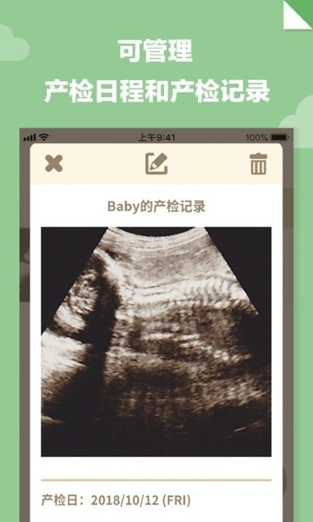 我的怀孕日记下载