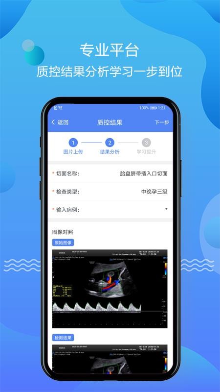 超声智库app v1.2.15